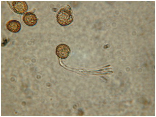 Tilletia tritici