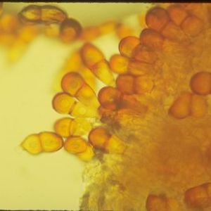 زنگ زرد گندم:Puccinia striiformis